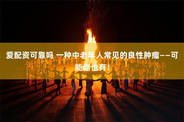 爱配资可靠吗 一种中老年人常见的良性肿瘤——可能你也有！